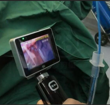 1280 Ｘ 720 카메라 결의안과 ICU EMS 단일 사용 삽관 비디오 후두경