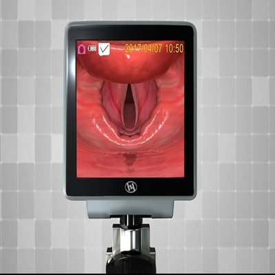 3.0 &quot; LCD 스크린 항공로 버릴 수 있는 비디오 후두경 960*480 화소
