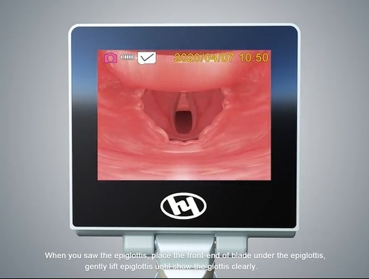 3.0 재사용할 수 있는 비디오 후두경 32 GB 의학 장비를 드러내세요